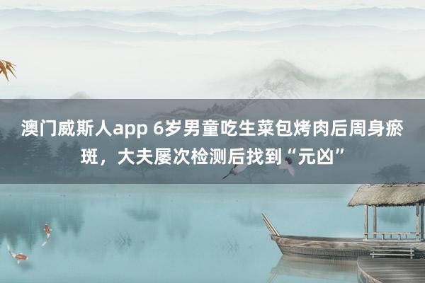 澳门威斯人app 6岁男童吃生菜包烤肉后周身瘀斑，大夫屡次检测后找到“元凶”